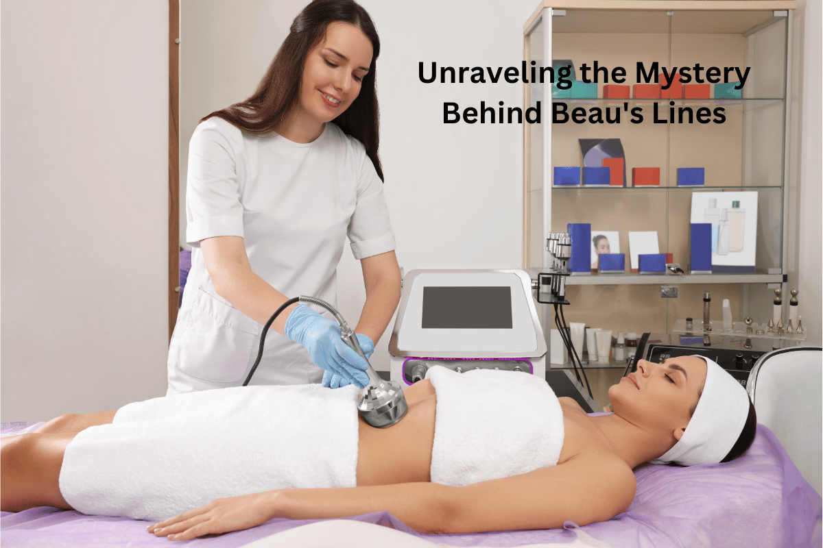 Unraveling the Mystery Behind Beau's Lines