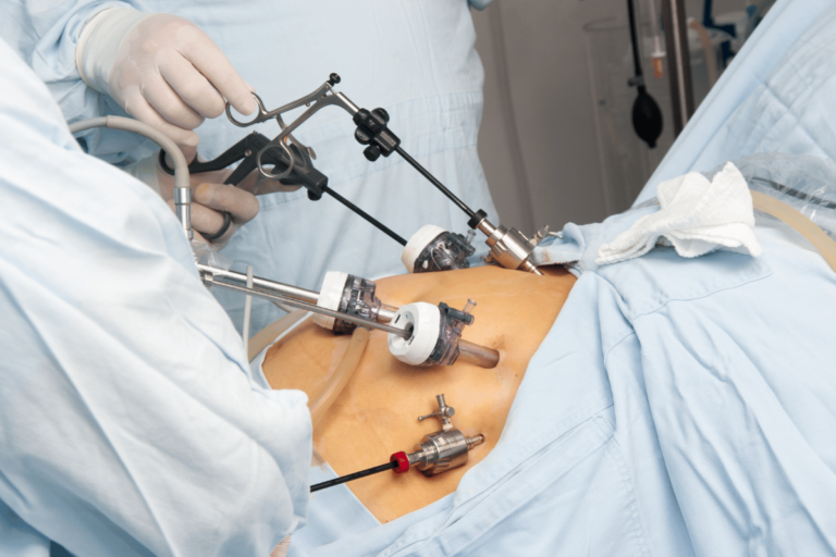 Bariatric Surgery Options Review: Weighing the Costs and Benefits